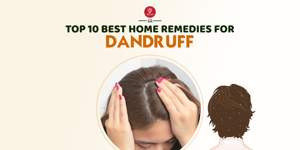 Home Remedies For Dandruff