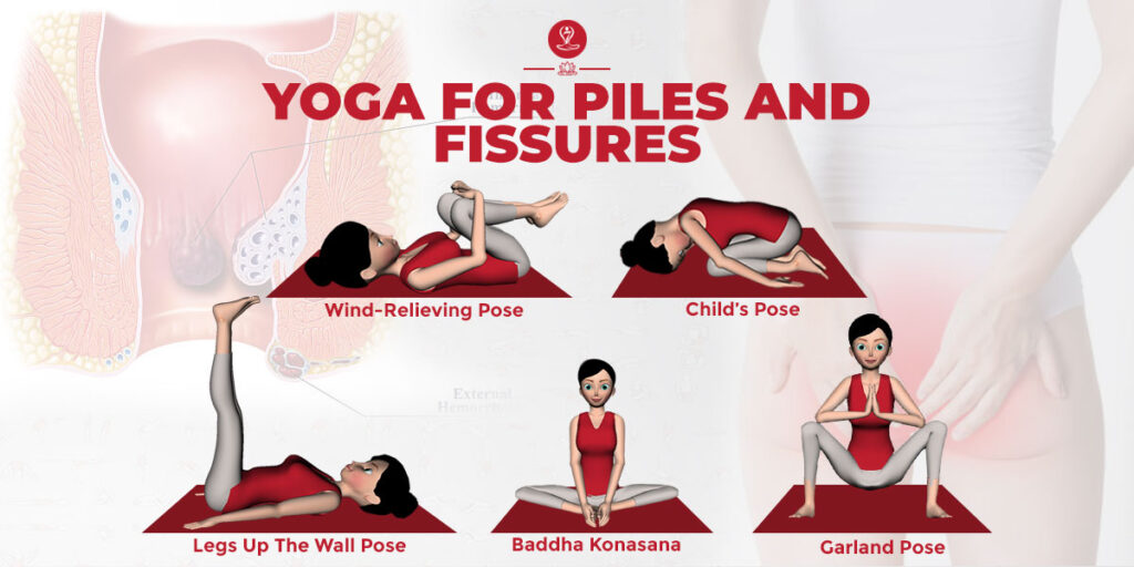 Effective Yoga For Piles (Fissures) Reduce Symptoms Of Hemorrhoids