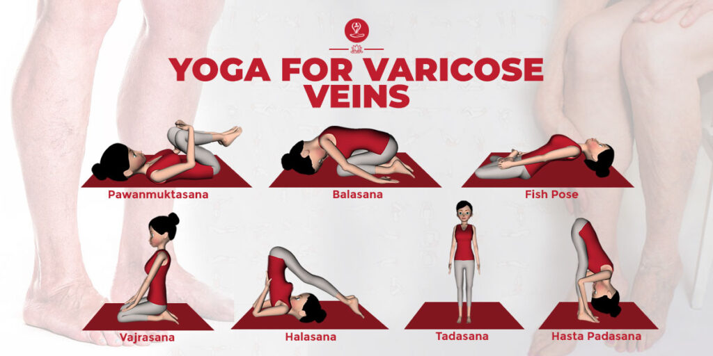 Yoga for Varicose Veins