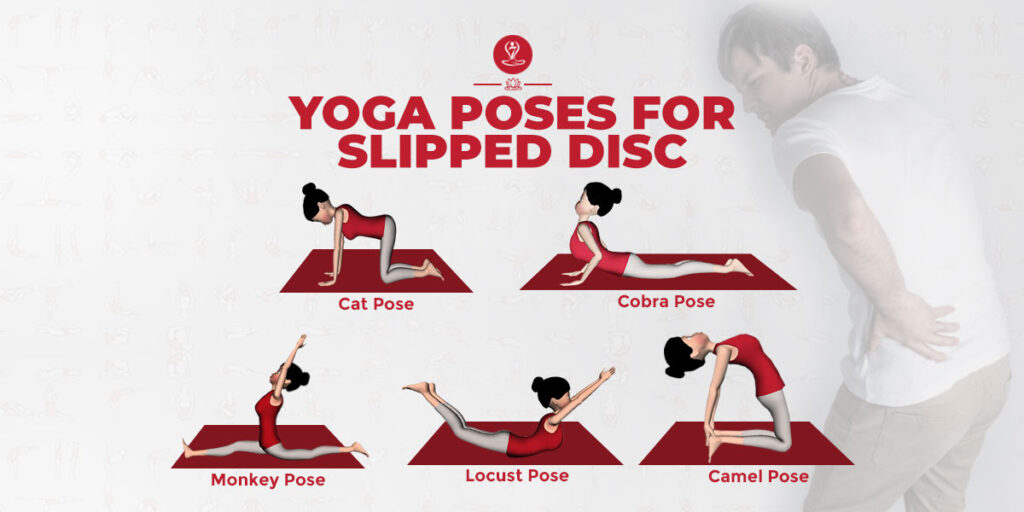 Yoga Poses For Slipped Disc
