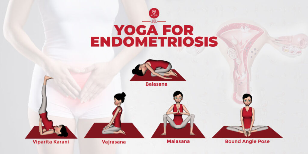 yoga for endometriosis