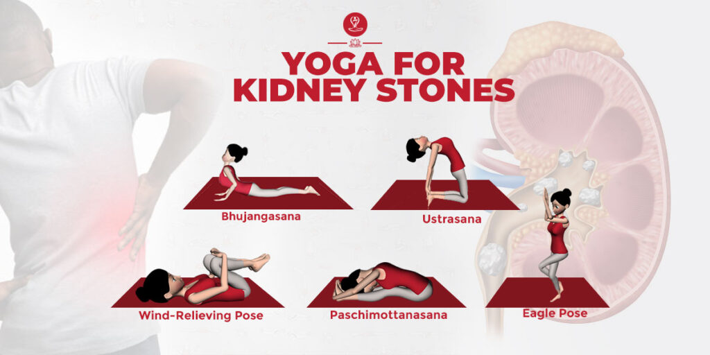 yoga for kidney stone