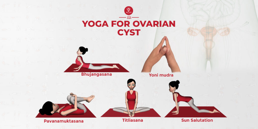 yoga for ovarian cyst