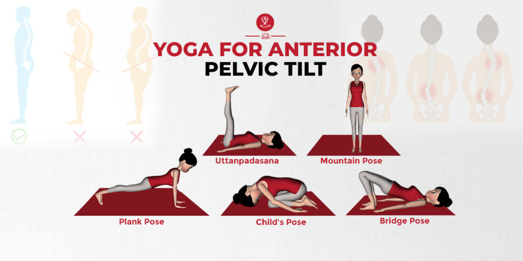 Yoga For Anterior Pelvic Tilt