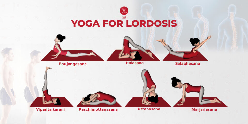 Yoga for Lordosis