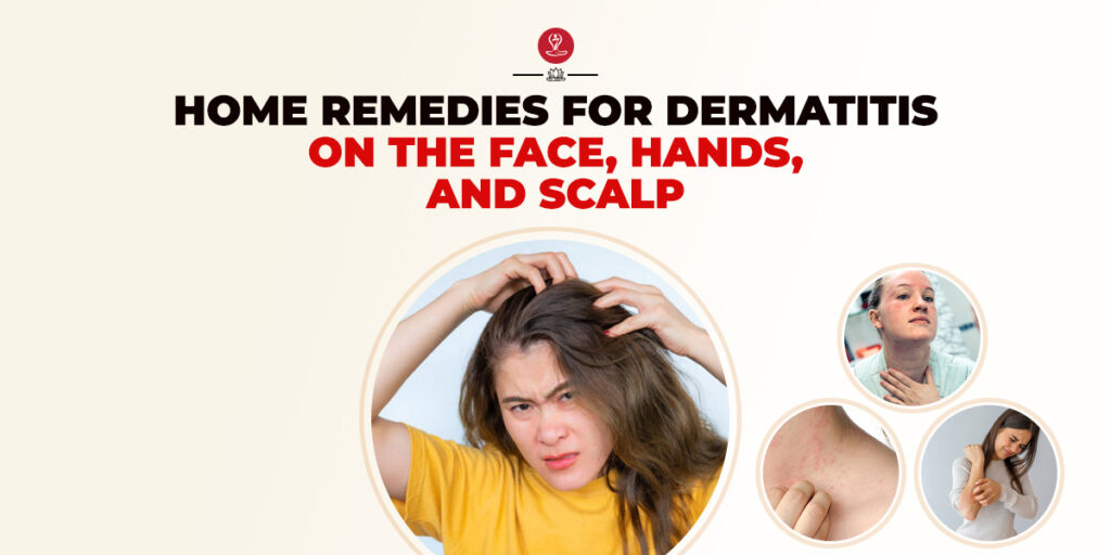 Home Remedies For Dermatitis
