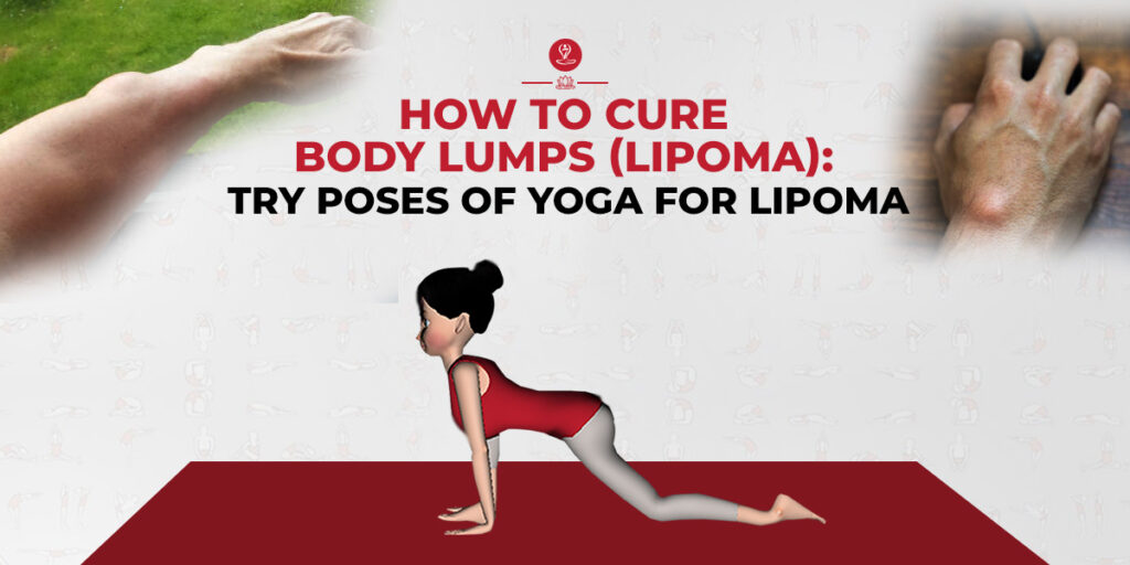 yoga for lipoma