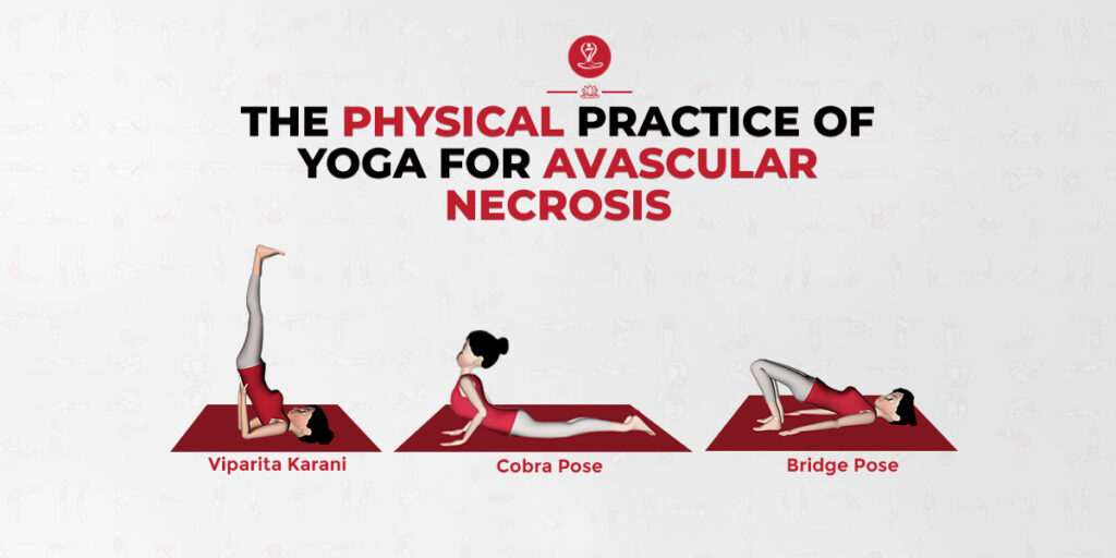 Yoga For Avascular Necrosis
