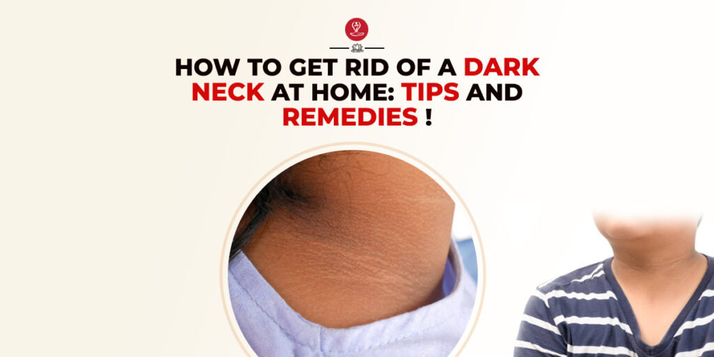Dark Neck Skin