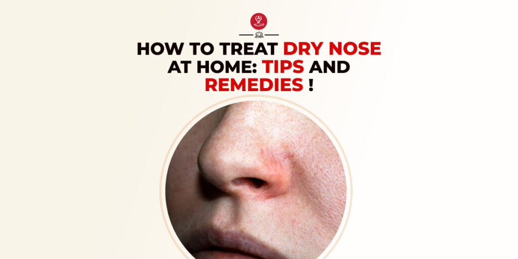 Dry Nose