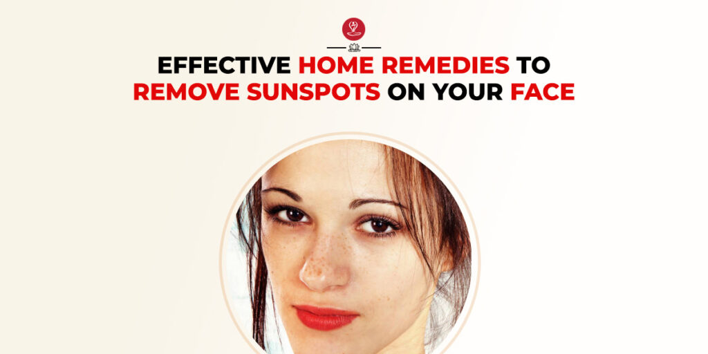 Home remedies for sunspots