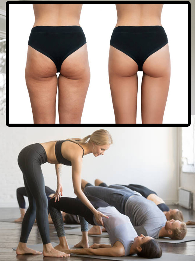 butt-img1