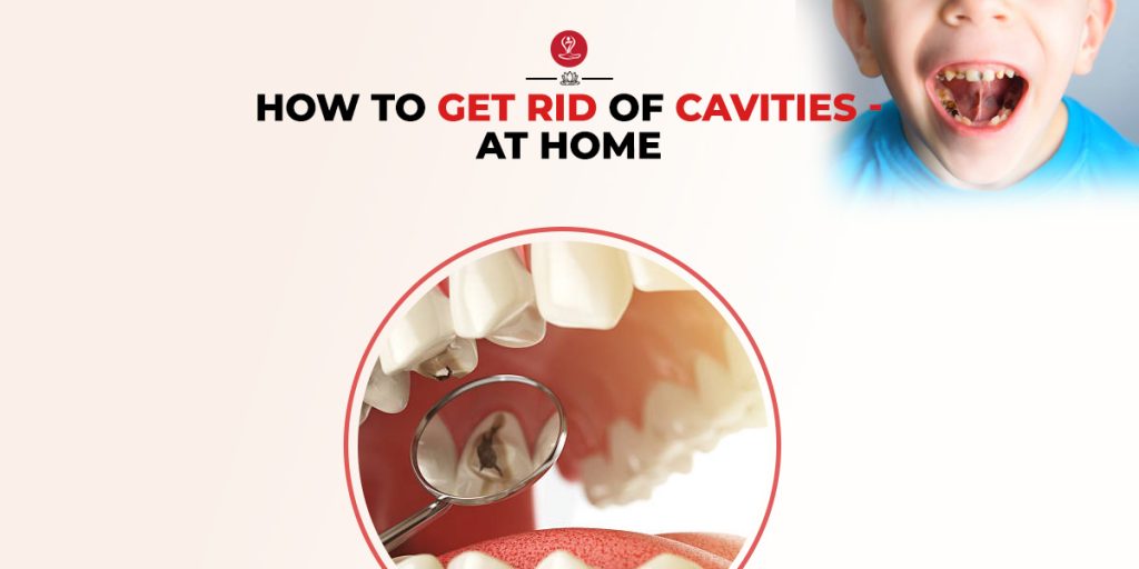 How To Get Rid of Cavities