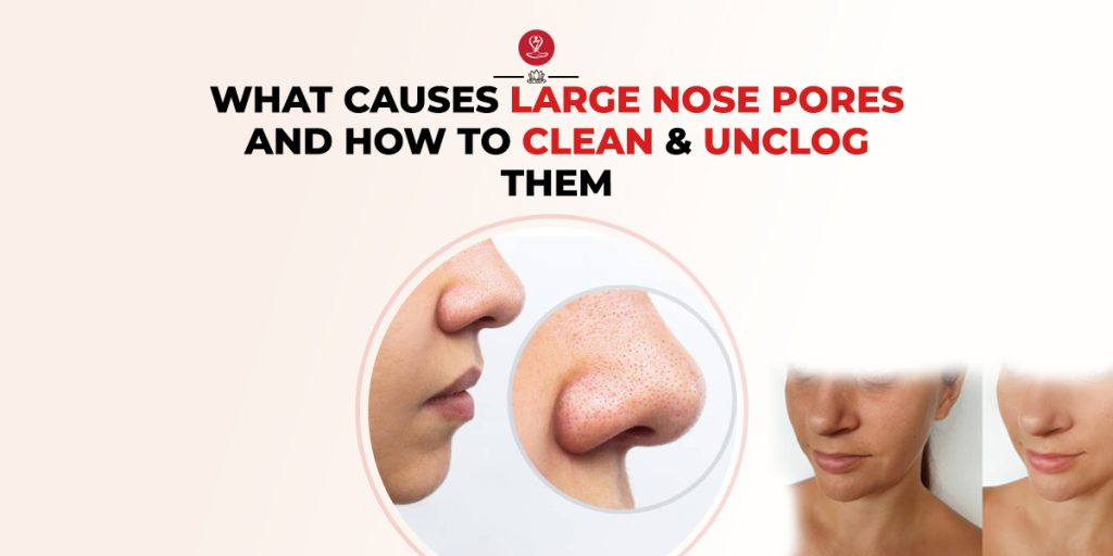 Nose Pores
