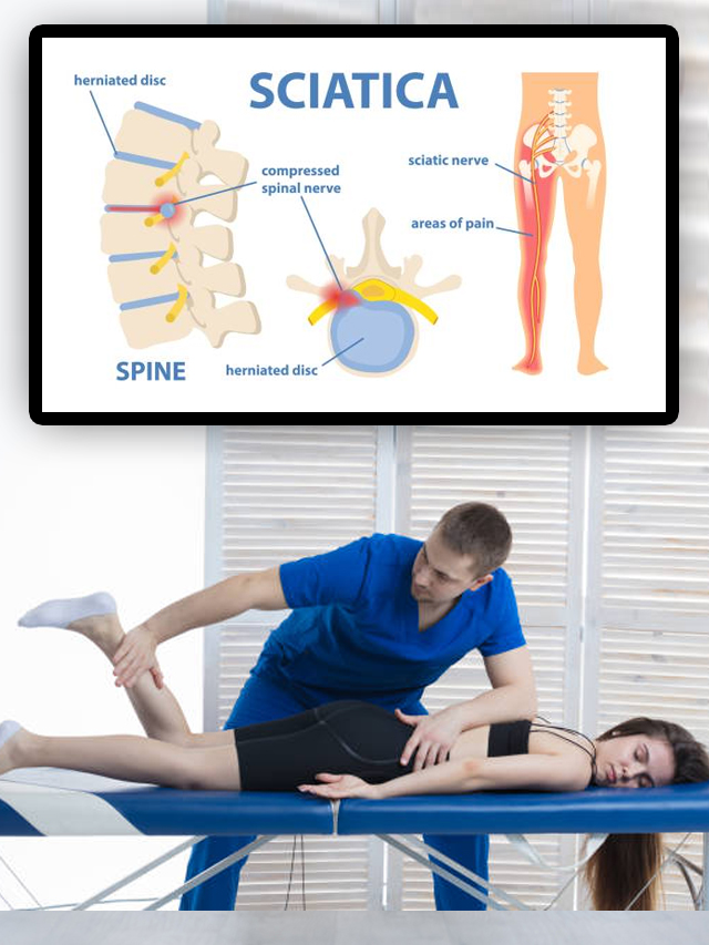 yoga-for-sciatica