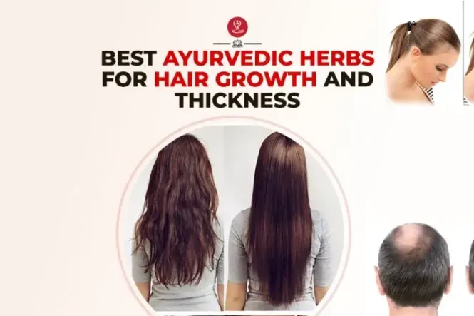 Best Ayurvedic herbs for hair growth infographic featuring bhringraj, amla, brahmi, hibiscus, fenugreek, scalp nourishment tips, hair fall reduction strategies, and natural remedies for thicker, healthier hair.