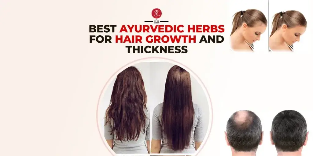 Best Ayurvedic herbs for hair growth infographic featuring bhringraj, amla, brahmi, hibiscus, fenugreek, scalp nourishment tips, hair fall reduction strategies, and natural remedies for thicker, healthier hair.