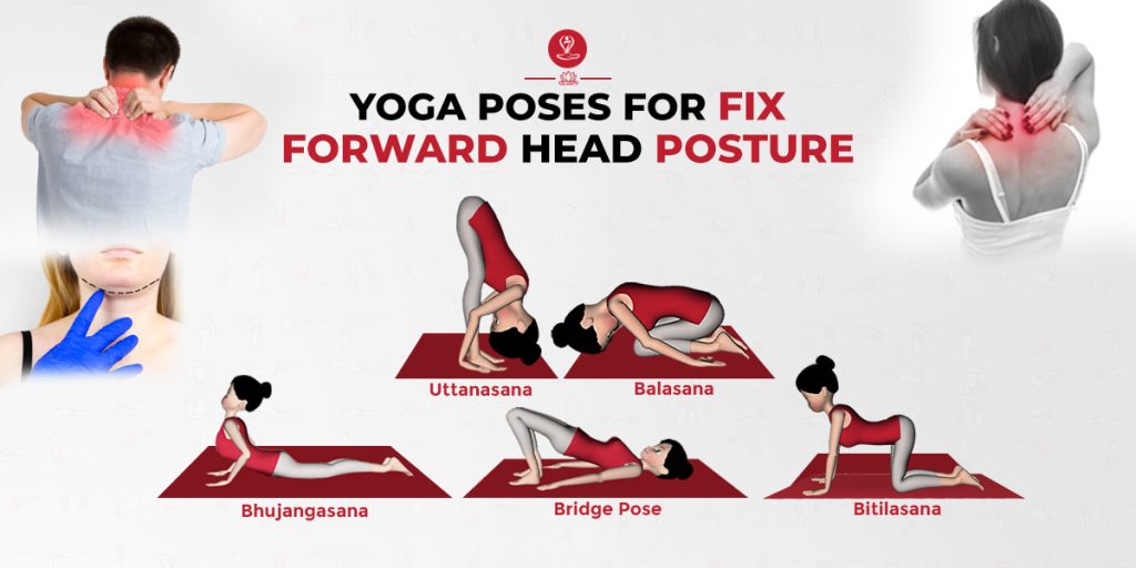 Forward Head Posture