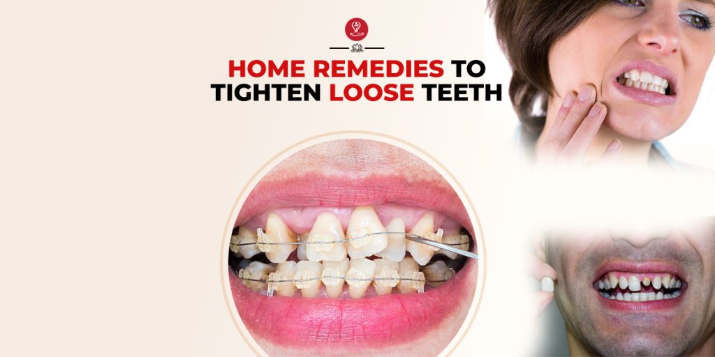 Tighten Loose Teeth