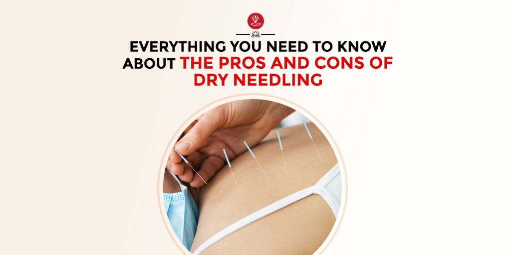 Dry Needling