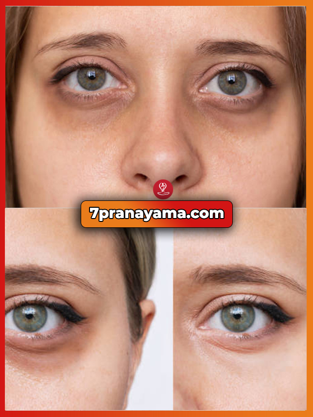eye