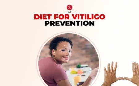 Healthy vitiligo diet foods on a wooden table