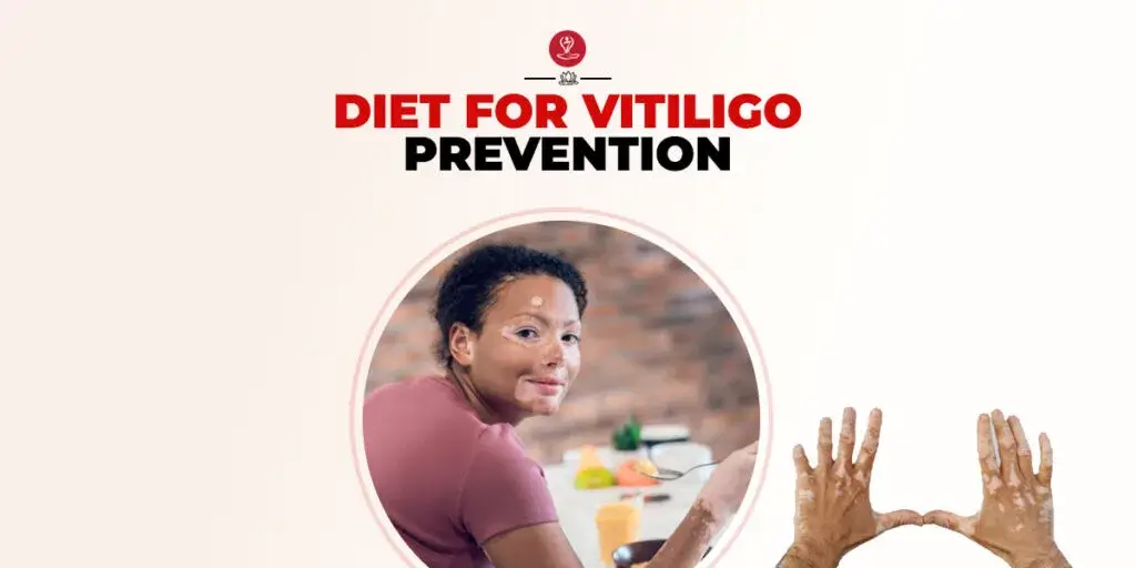 Healthy vitiligo diet foods on a wooden table